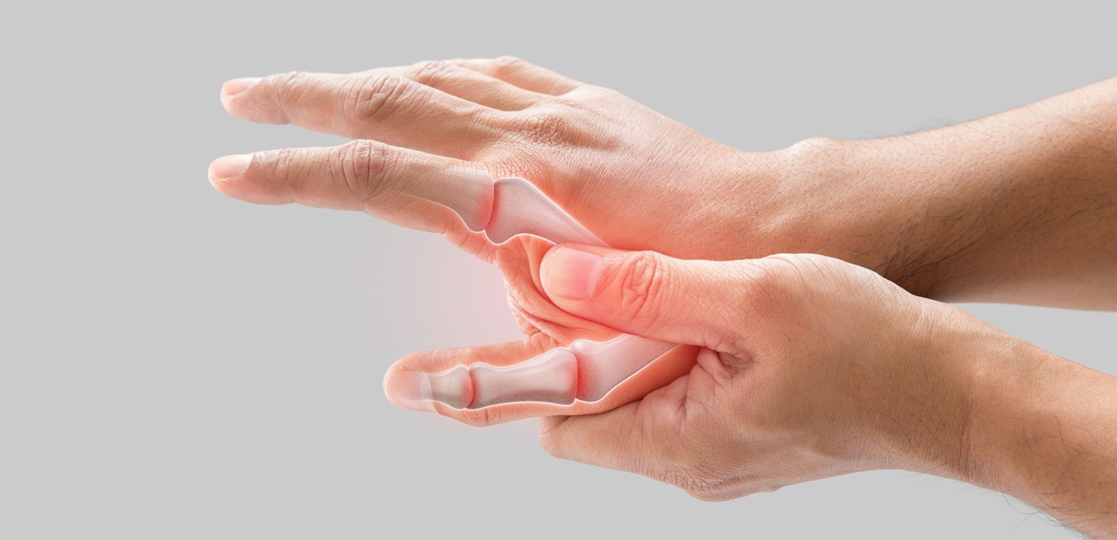 التهاب المفاصل الروماتيزمي   Rheumatoid Arthritis (RA)