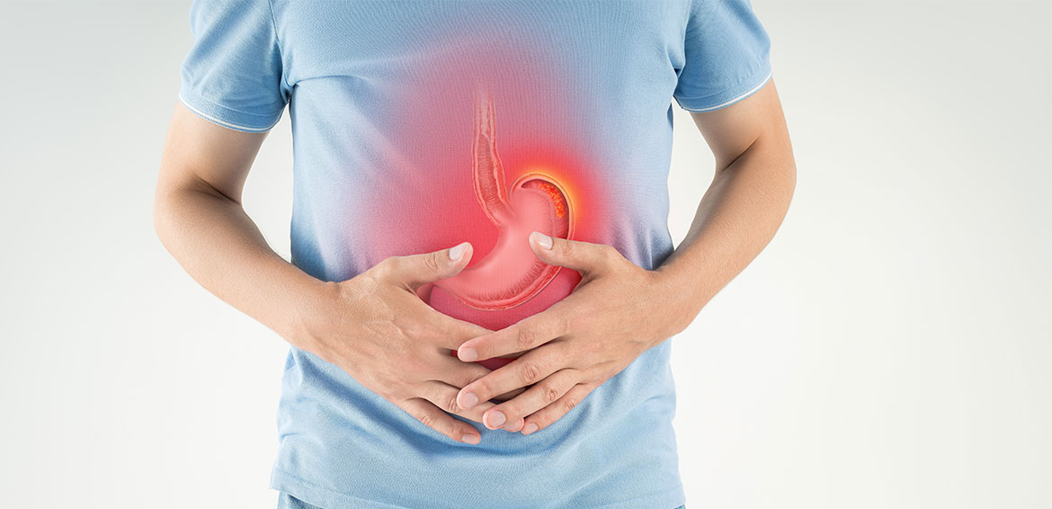 التهاب المعدة والأمعاء “Gastroenteritis”